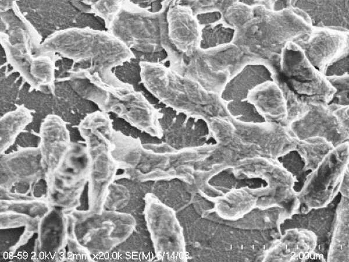 Microscopic image of Aeromonas hydrophila, bacterium believed to be responsible for flesh-eating disease that has stricken a Georgia woman.