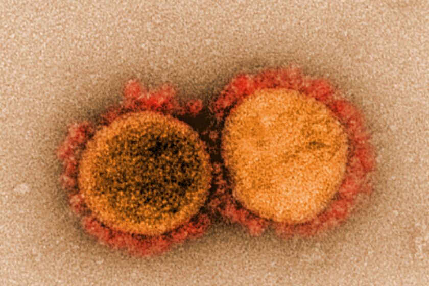 An electron micrograph shows SARS-CoV-2 particles isolated from a patient.