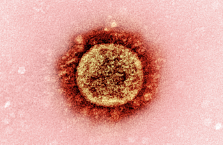 A specimen of the B.1.1.7 coronavirus variant from the United Kingdom is seen under a microscope.
