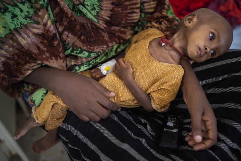 Hamdi Yusuf, a malnourished child, is held by her mother in Dollow, Somalia on Wednesday, Sept. 21, 2022. She was little more than bones and skin when her mother found her unconscious, two months after arriving in the camps and living on scraps of food offered by neighbors. (AP Photo/Jerome Delay)