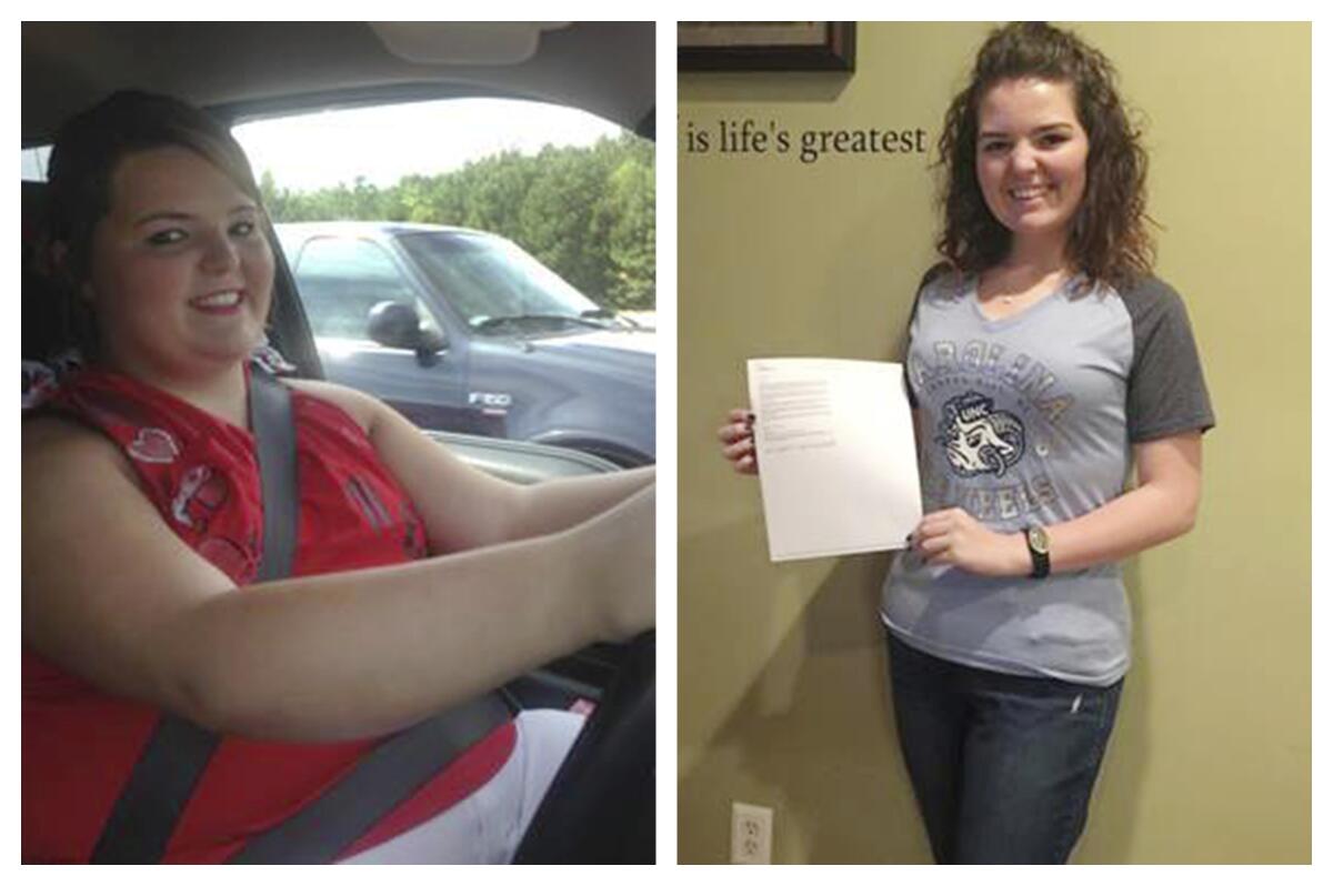 Faith Newsome before and after gastric bypass surgery
