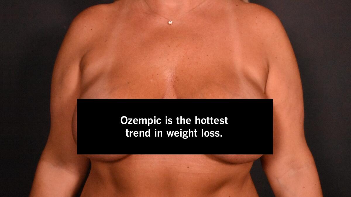 What are Ozempic Breasts? - Graham Plastic Surgery
