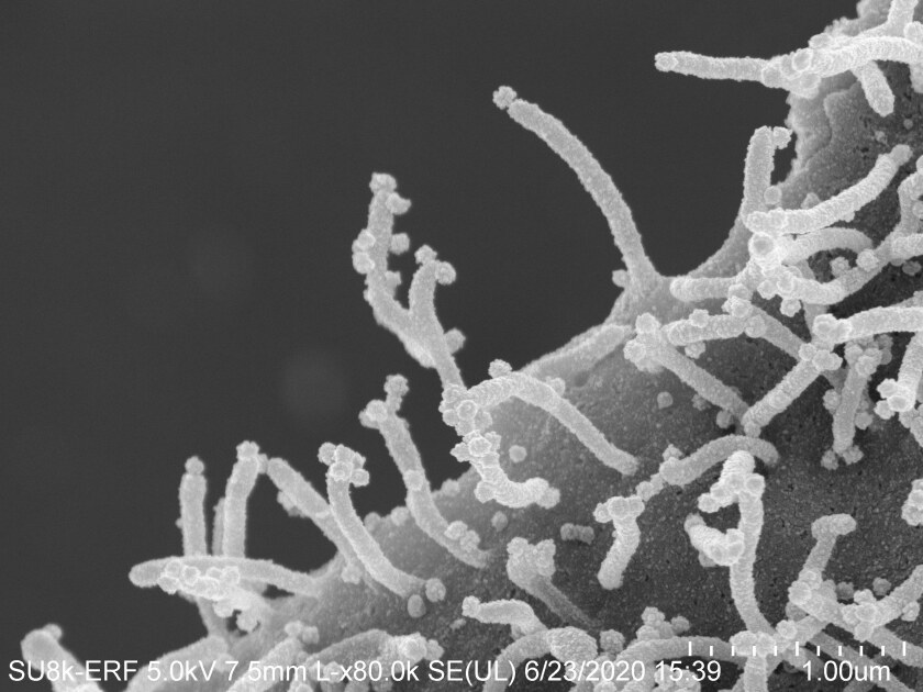 Una célula infectada con coronavirus llega a nuevos huéspedes.