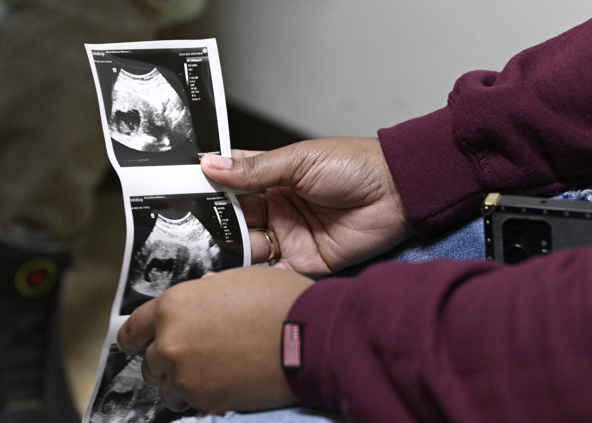 A woman holds a strip of black-and-white images of a fetus. 
