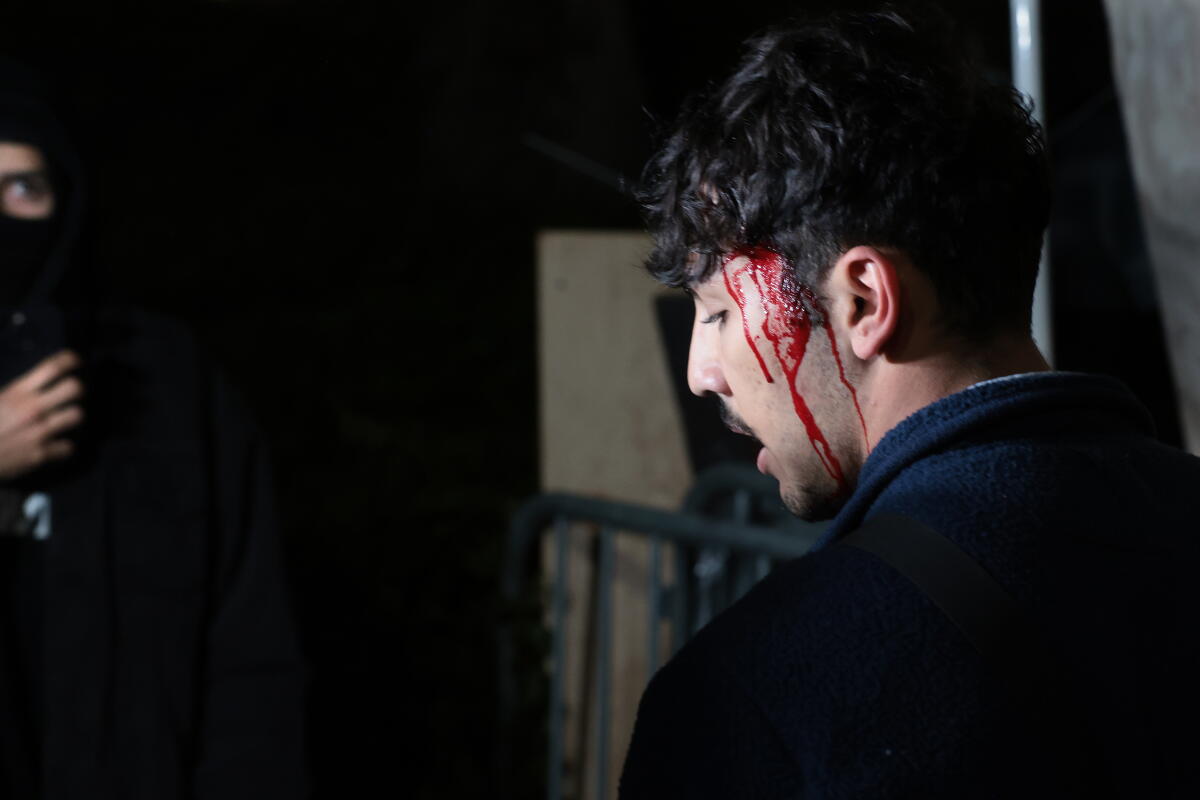 A Pro-Palestinian protester bleeds from his head after clashing with pro-Israeli