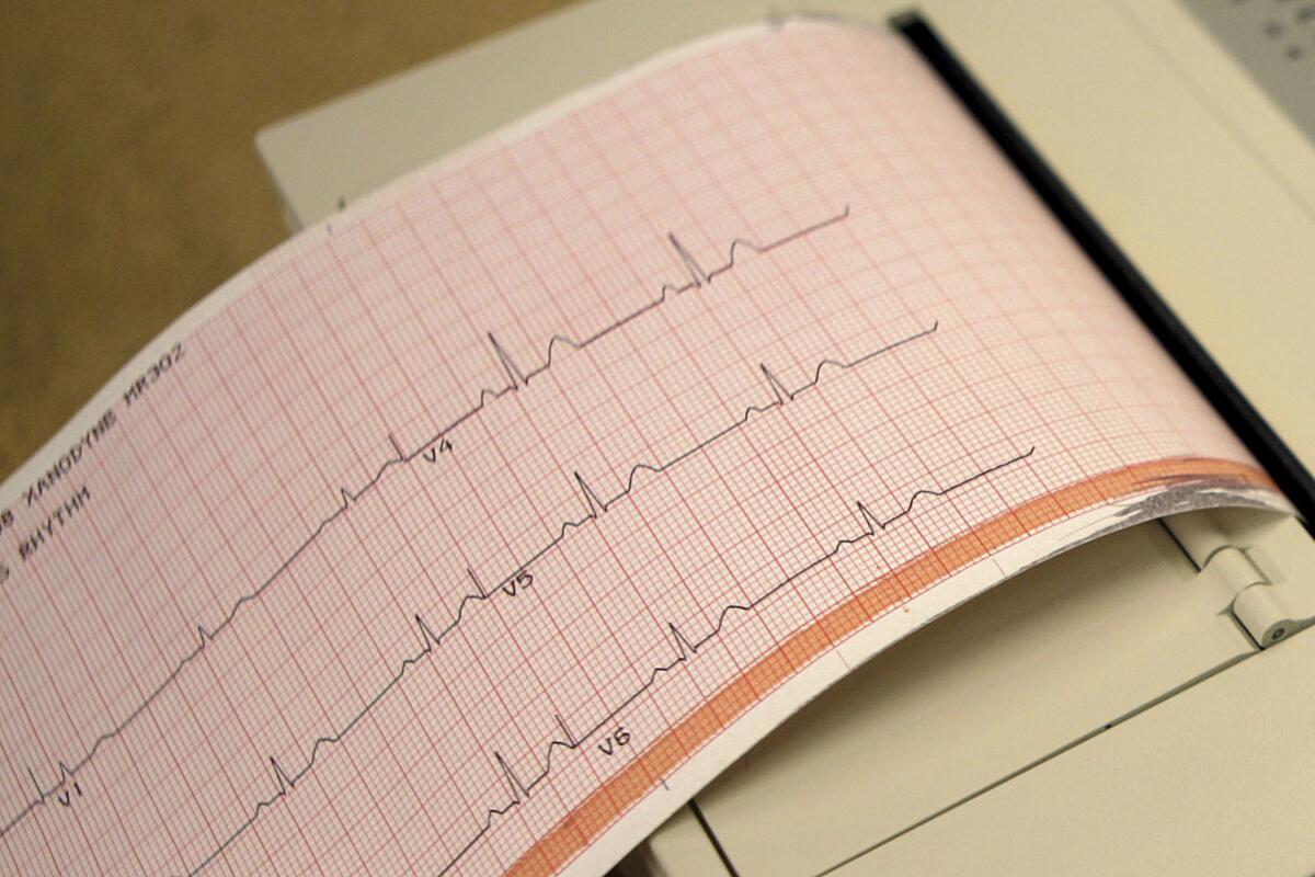 A computer printout shows the wavy lines of an electrocardiogram test