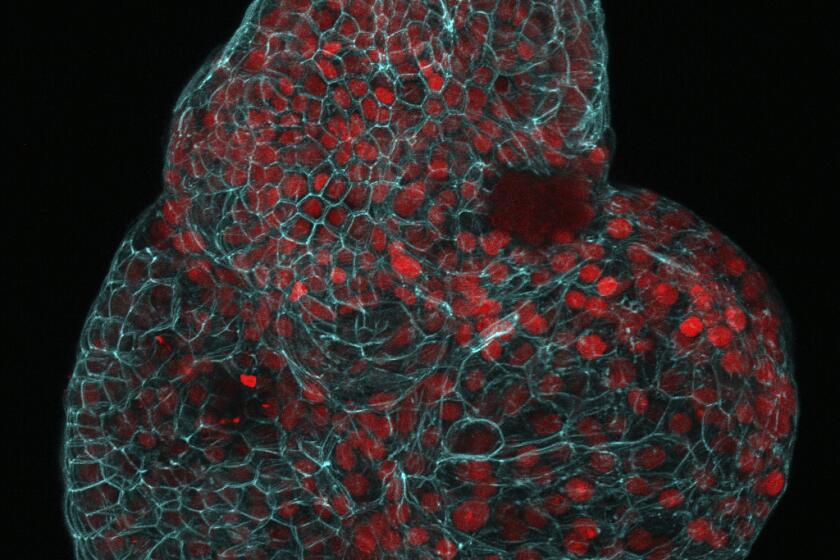 Esta imagen de microscopio facilitada por los investigadores en marzo de 2024 muestra un organoide pulmonar creado a partir de células recogidas del líquido amniótico. (Giuseppe Calà, Paolo De Coppi, Mattia Gerli via AP)