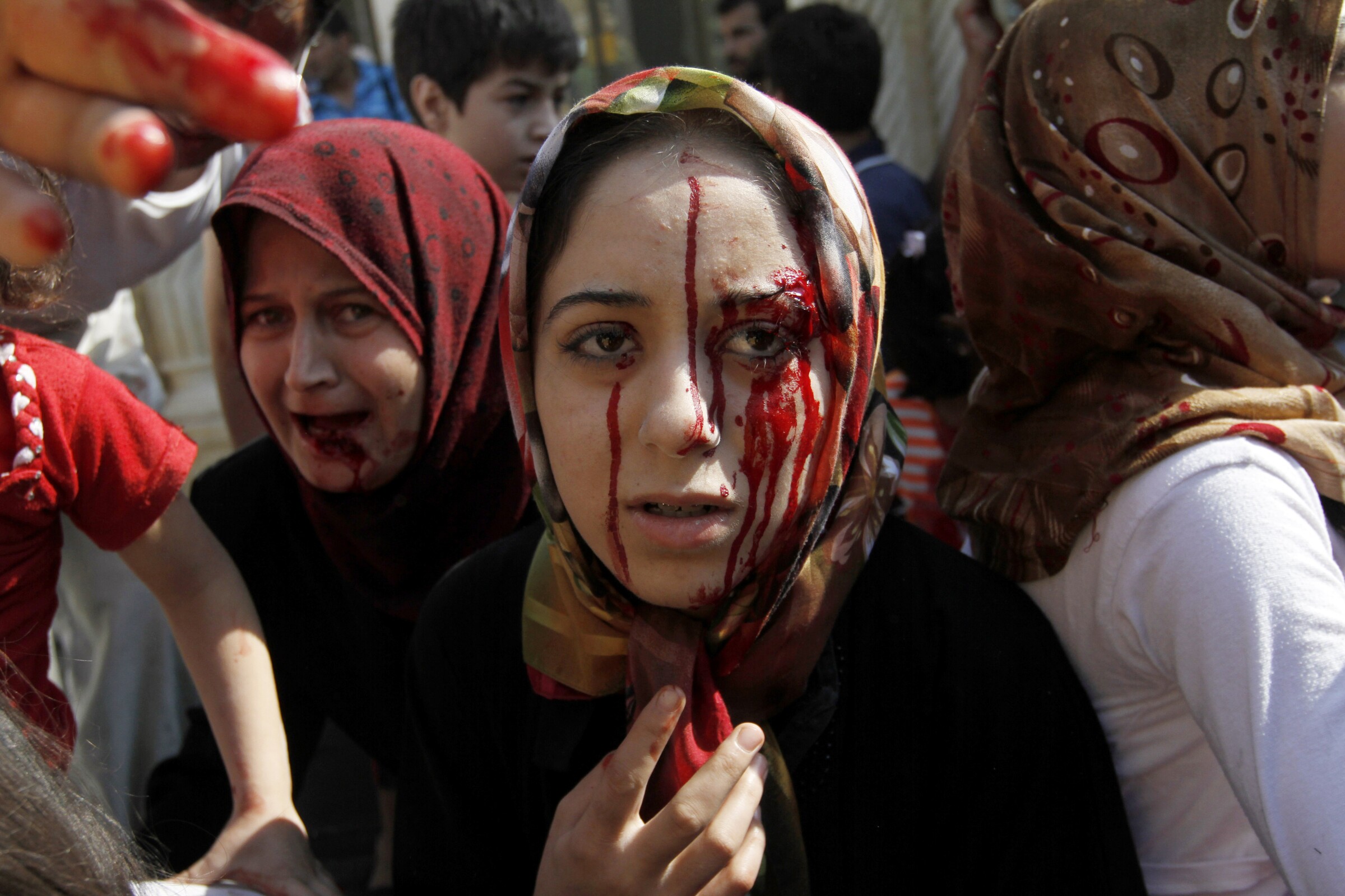 Injured Syrian women after an airstrike in 2012.