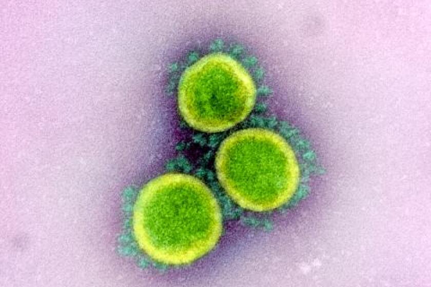 A color-enhance image of SARS-CoV-2 coronavirus isolated from a patient.