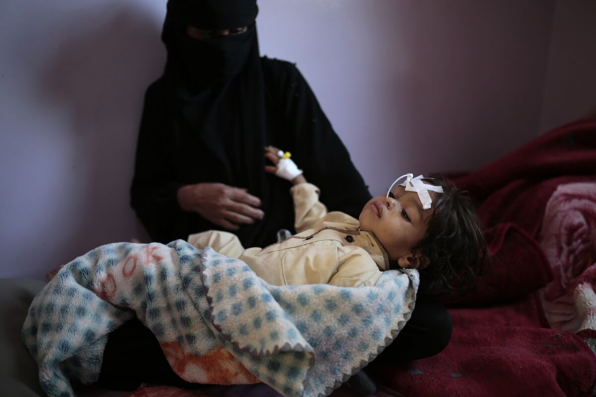 A woman holds a malnourished boy in Sanaa, Yemen.