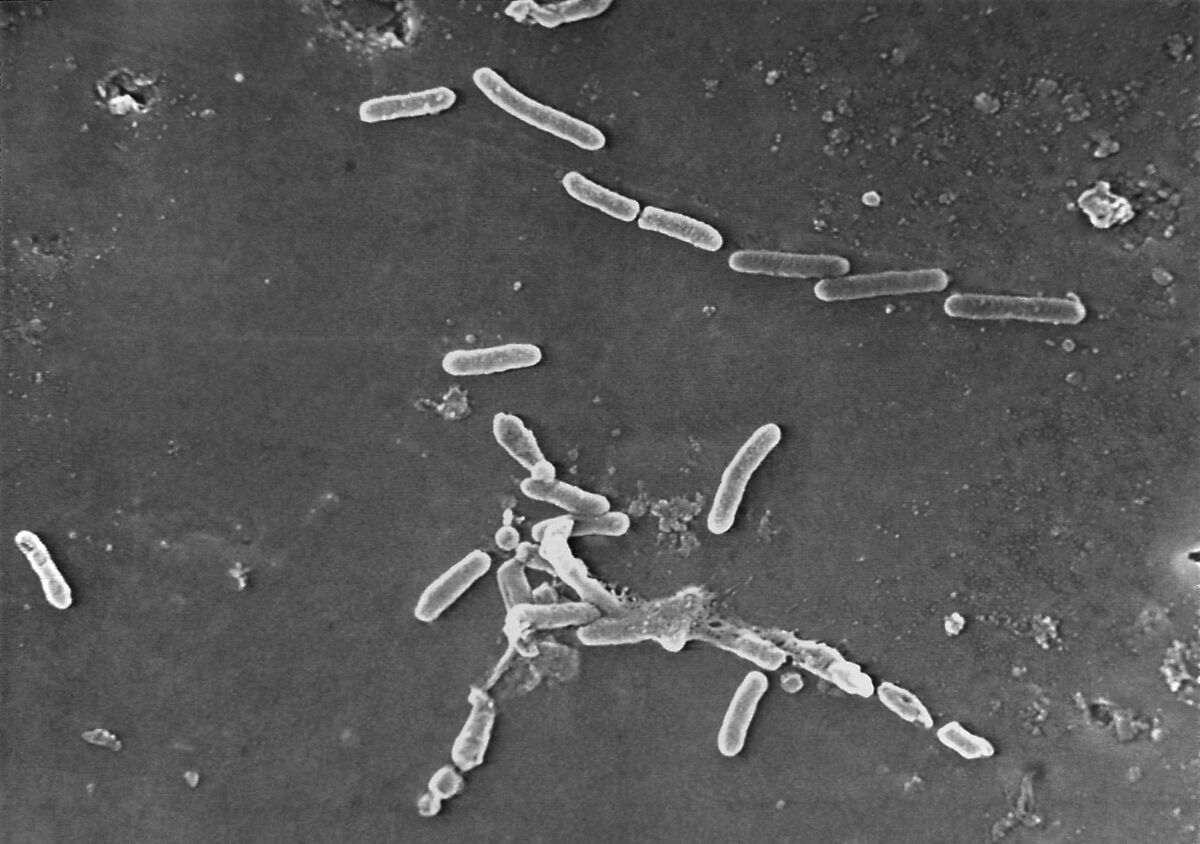 This scanning electron shows rod-shaped Pseudomonas aeruginosa bacteria. 
