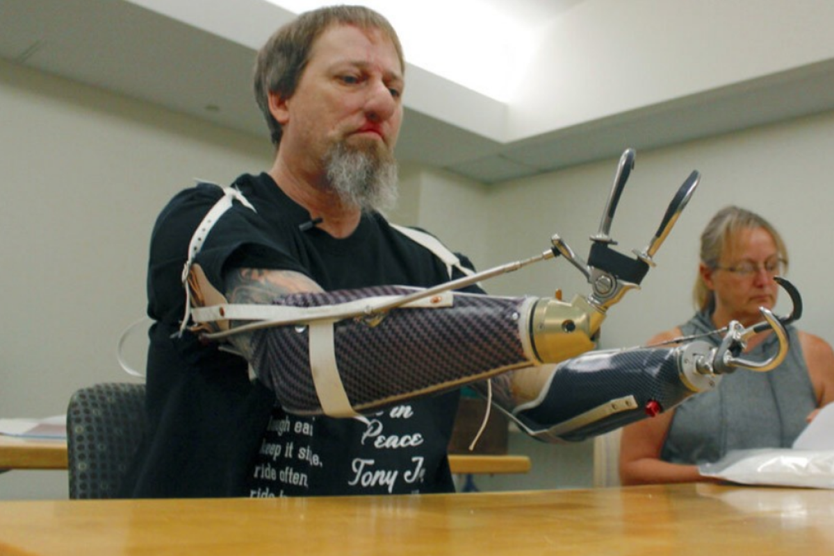 Greg Manteufel, acompañado por su esposa, Dawn, prueba un nuevo brazo protésico durante la terapia ocupacional en Milwaukee el 19 de agosto.