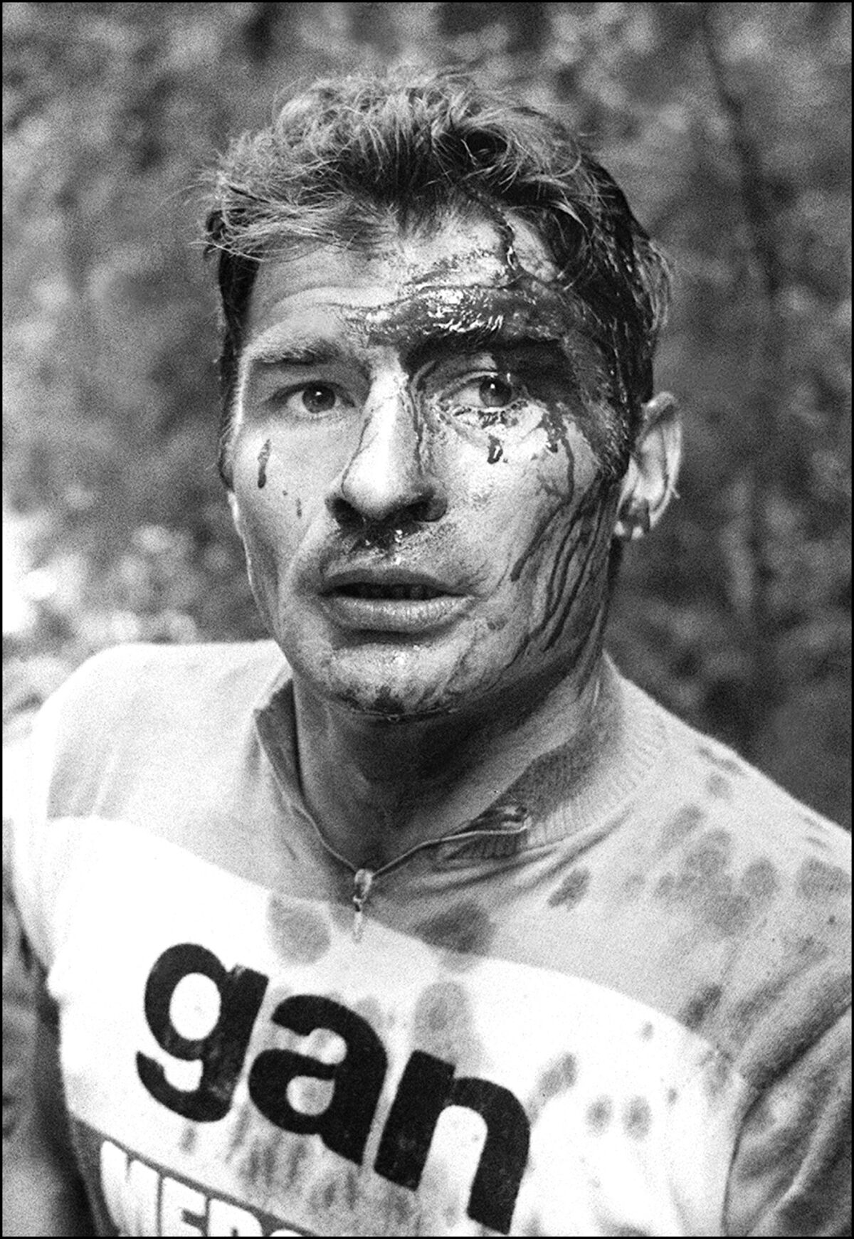 Raymond Poulidor after a fall in 1973 Tour de France