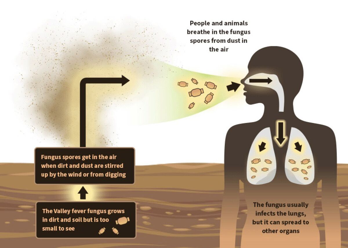 An infographic shows how spores of the valley fever fungus can be kicked up into the air and infect people who inhale them