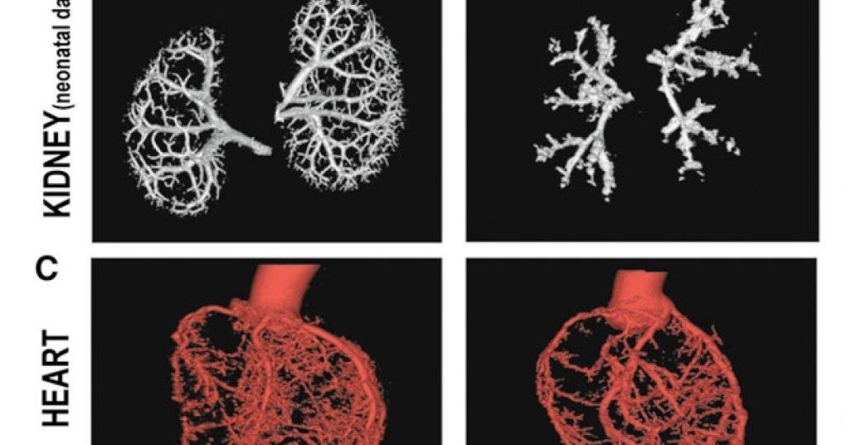 Artery formation process discovered - The San Diego Union-Tribune