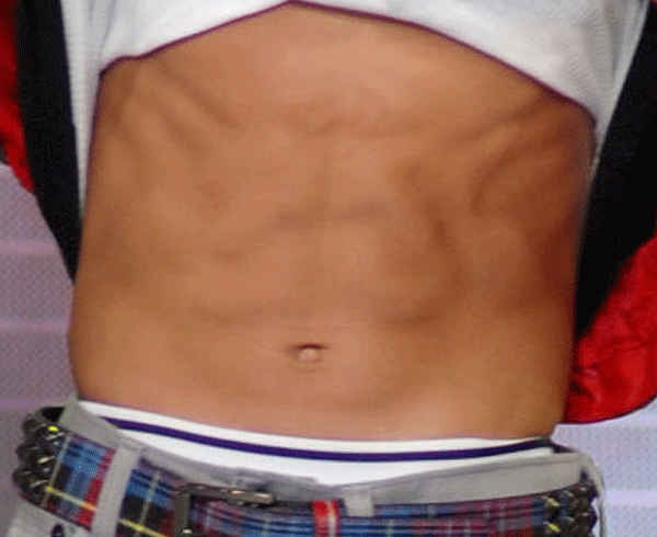 Famous abs