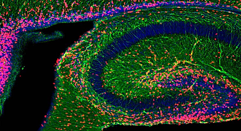 Neuron proliferation increased in the developing hippocampus of a mouse following an injection of neuronal exosomes.
