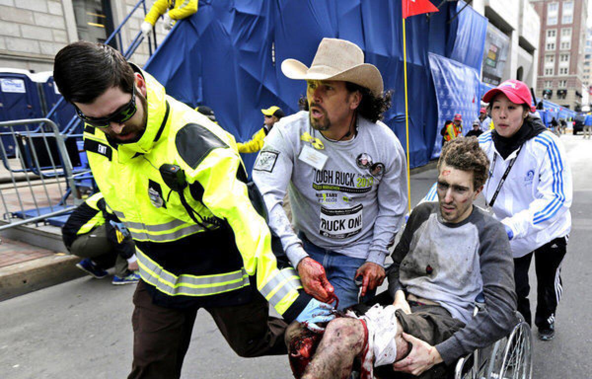 Jeff Bauman had both legs amputated above the knee after being injured in the bombing at the Boston Marathon.
