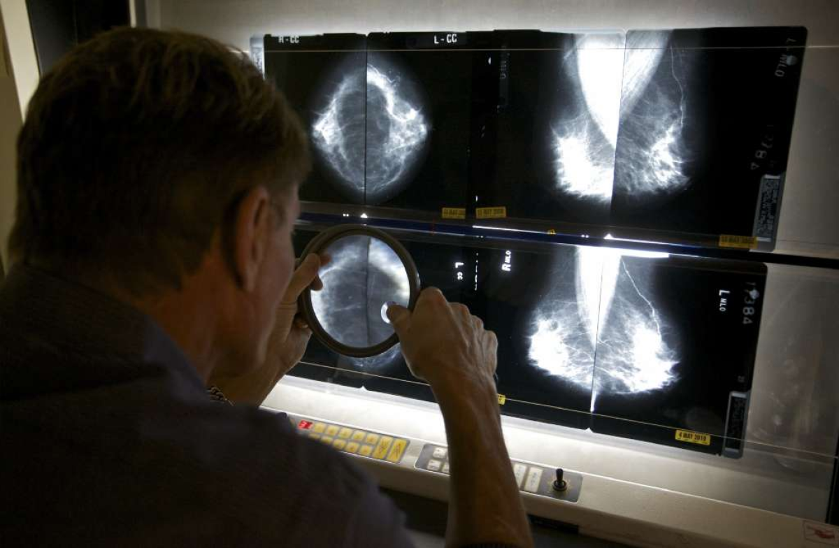 False-positive results from screening mammograms produce a significant -- though temporary -- increase in anxiety, a new study finds.