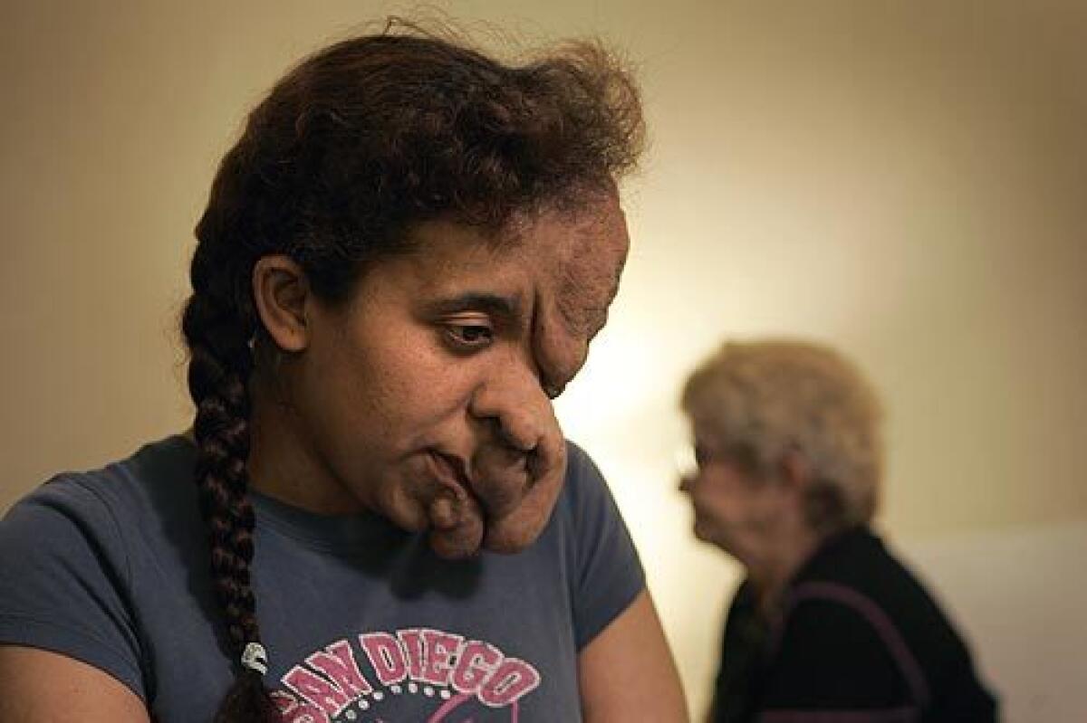 Ana Rodarte with her friend Fran Vigil the night before the first surgery.