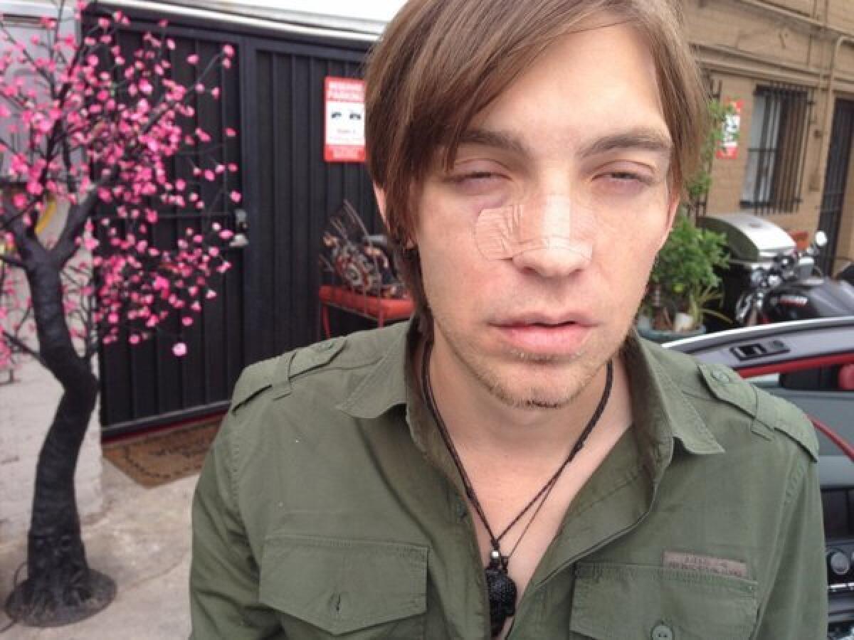 The Calling's Alex Band released this photo after an alleged assault on Sunday in Michigan.