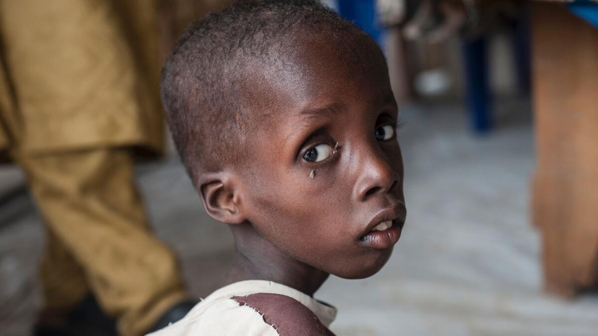 A malnourished boy at a camp for displaced people outside Maiduguri, the capital of northeastern Nigeria's Borno state.