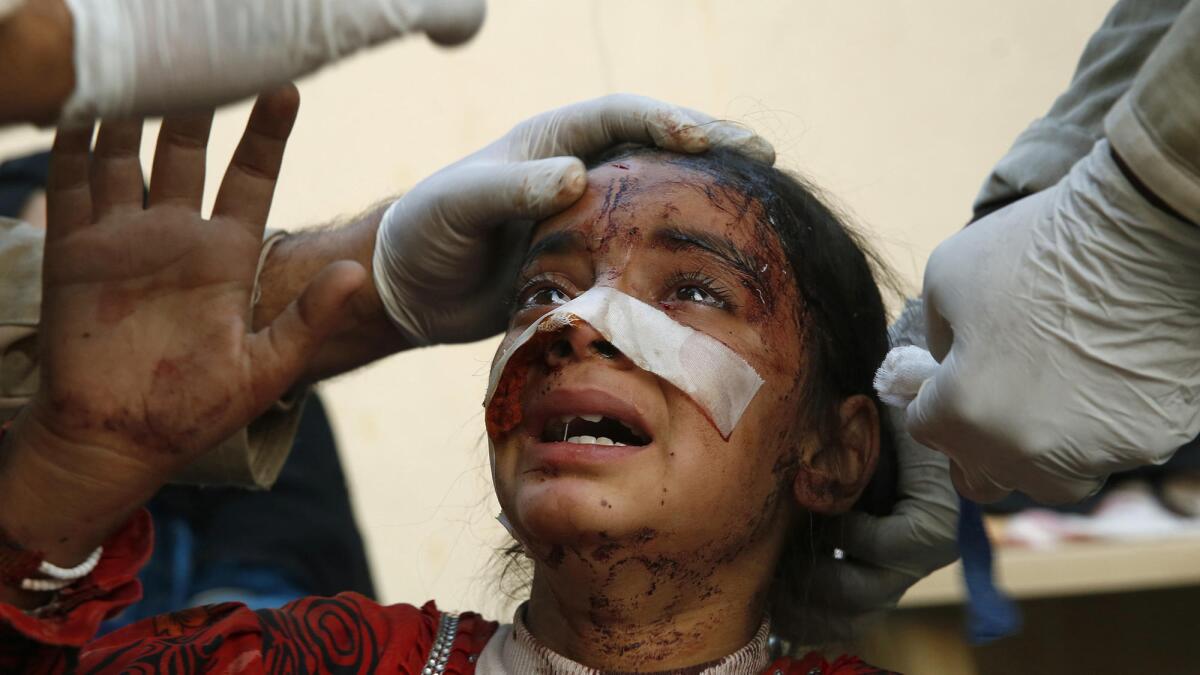 Menar Hassan, 8, cries as doctors treat her wounds after a suicide bombing. Her father died in the blast.
