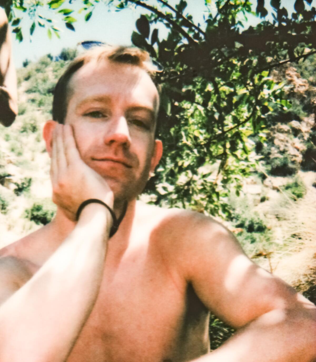 Patrick Nathan, shirtless, sits under a tree and rests his hand on his cheek.