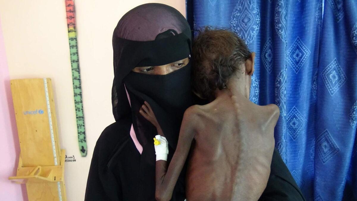 Nadia Nahari with 5-year-old son Abdelrahman Manhash at a clinic in western Yemen in November. The United Nations Food Program says nearly 3 million children and pregnant or nursing mothers are malnourished in the war-ravaged country.