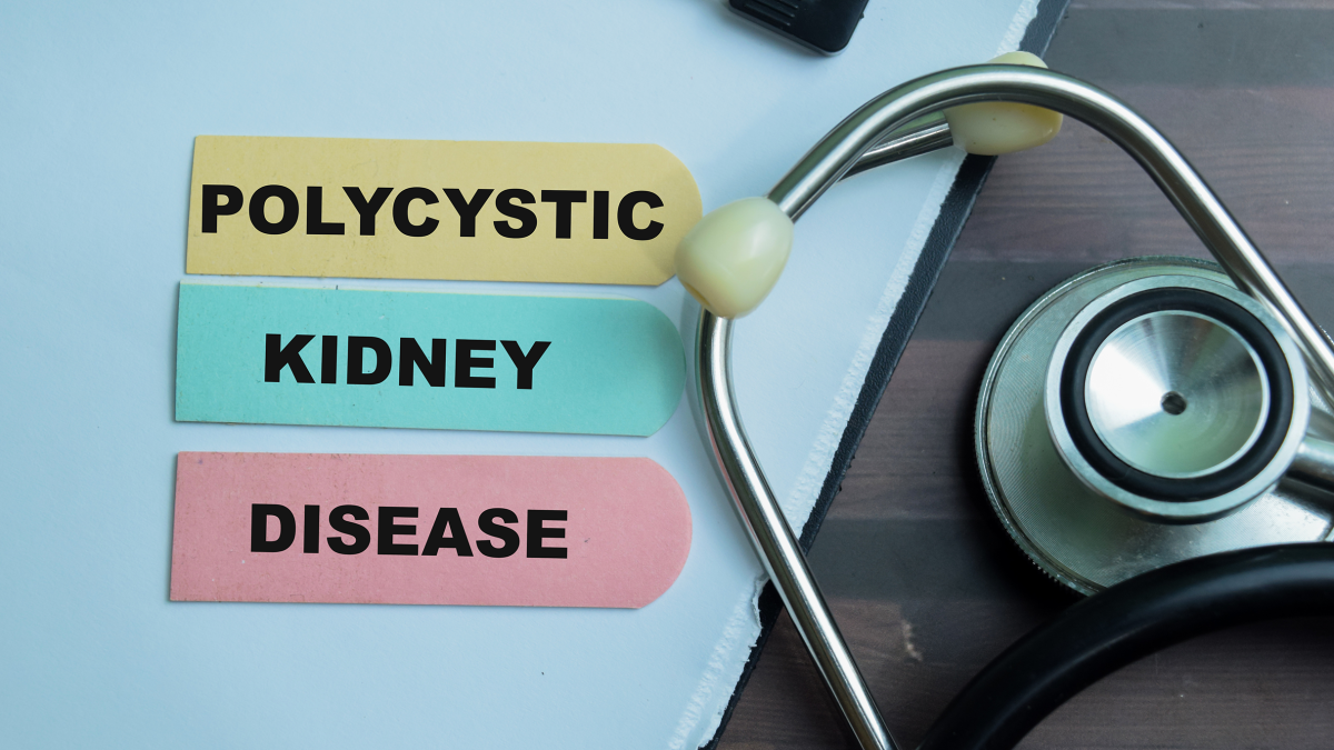 Concept of Polycystic Kidney Disease write on sticky notes with black stethoscope isolated on Wooden Table.