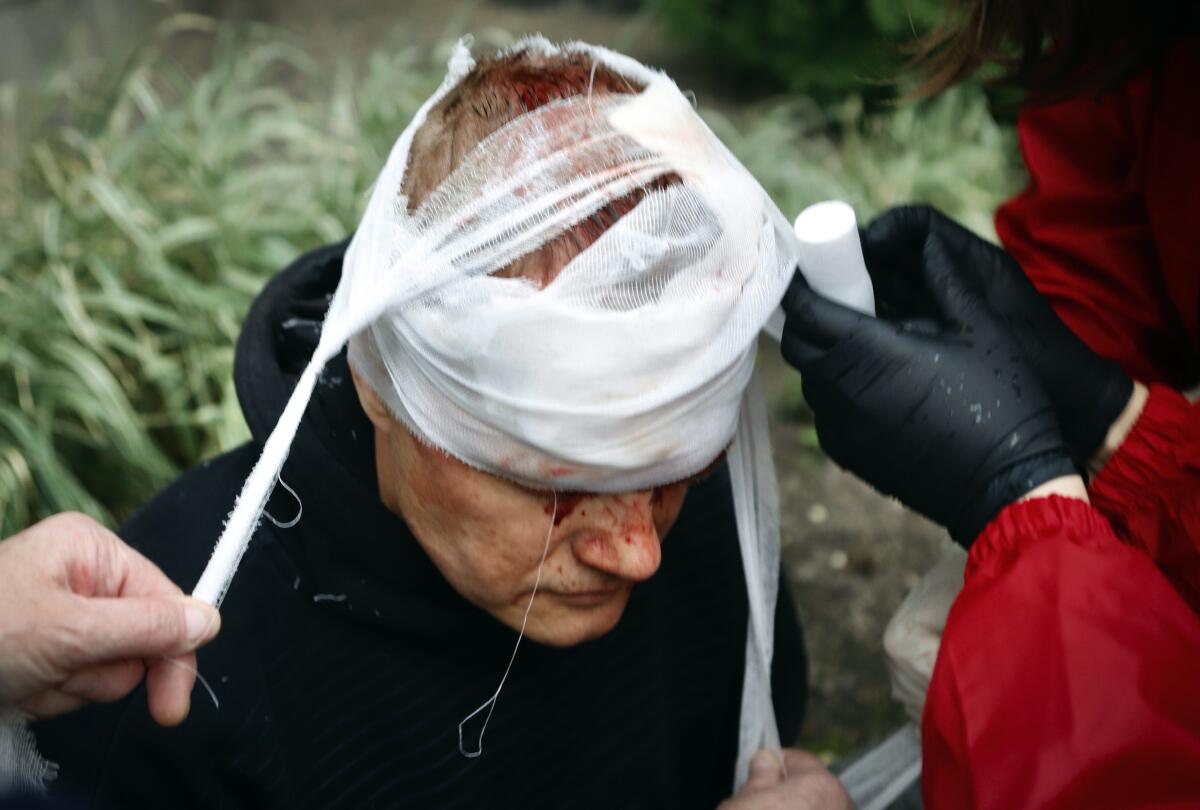 Wounded protester in rally against Belarus President Alexander Lukashenko