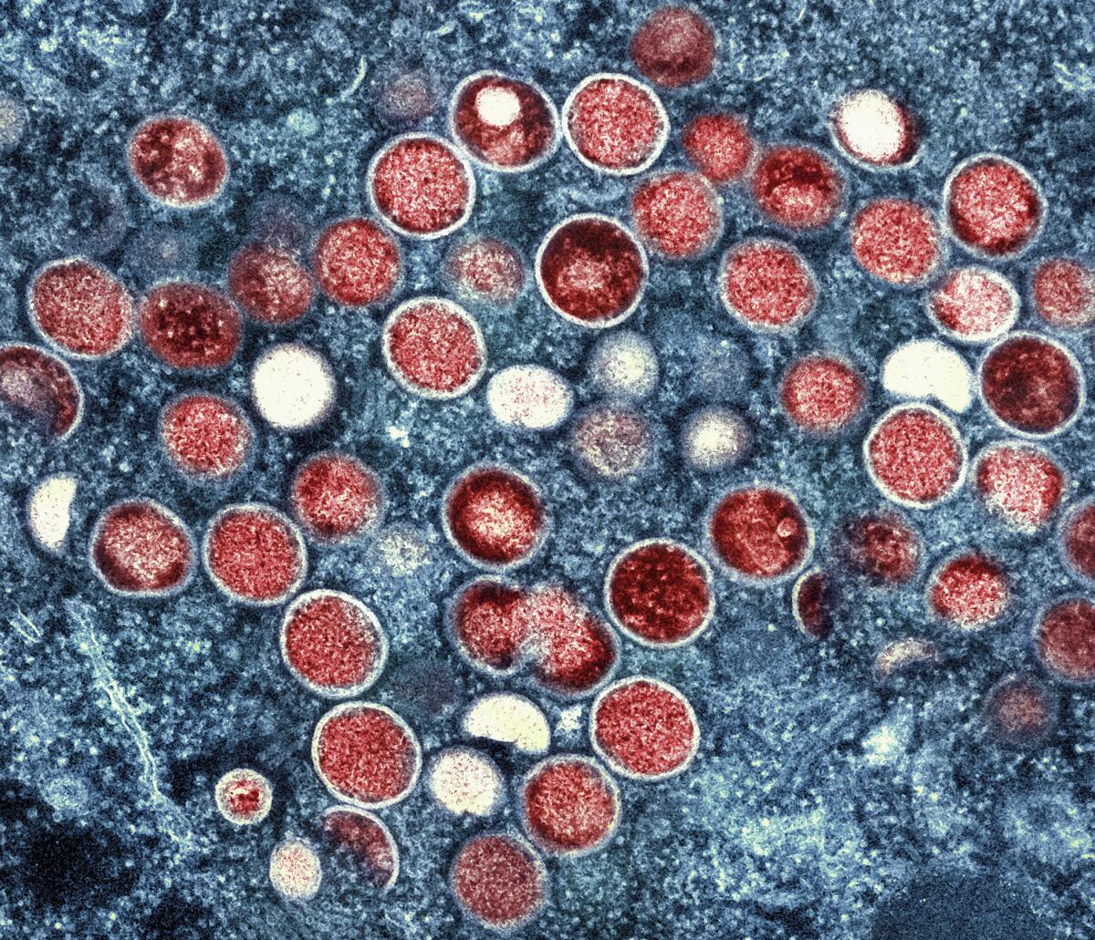 FILE - This image provided by the National Institute of Allergy and Infectious Diseases (NIAID) shows a colorized transmission electron micrograph of monkeypox particles (red) found within an infected cell (blue), cultured in the laboratory that was captured and color-enhanced at the NIAID Integrated Research Facility (IRF) in Fort Detrick, Md. The official IRNA news agency reported announced Tuesday, Aug. 16, 2022, the first case of monkeypox in the nation. The report said health authorities quarantined a 34-year-old woman living in the southwestern city of Ahvaz. (NIAID via AP, File)