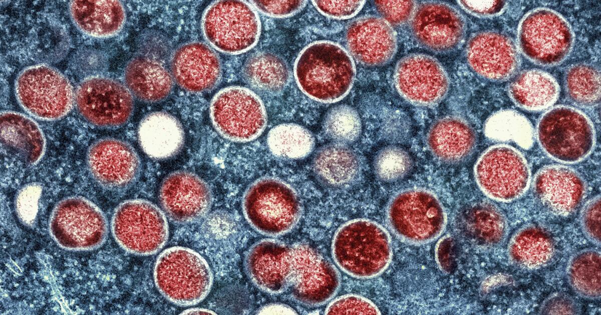 2 cases of possibly more severe mpox strain is confirmed in L.A. County 2 cases of possibly more severe mpox strain is confirmed in L.A. County