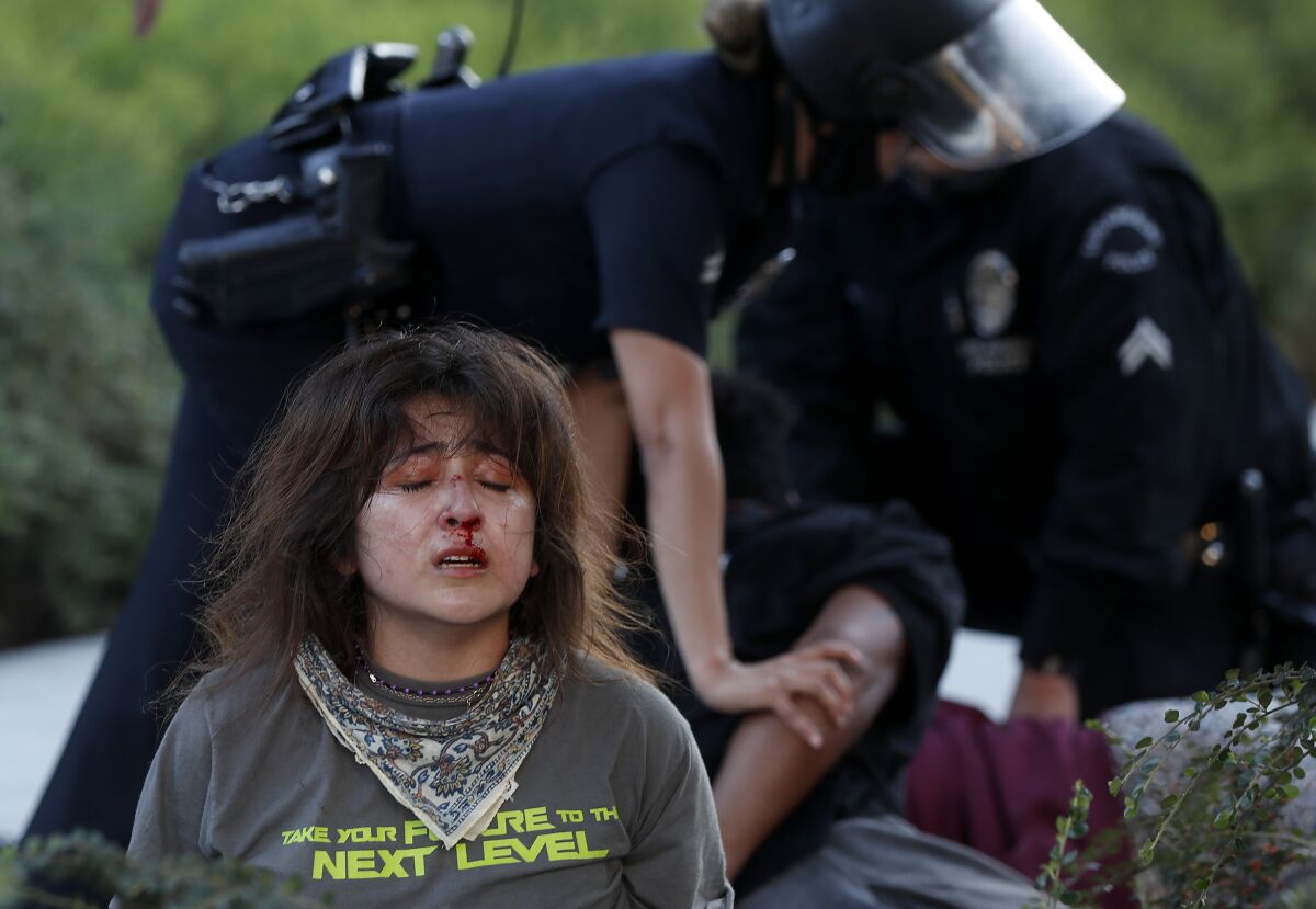 A woman's face is bloodied as LAPD officers take down protesters on July 25.
