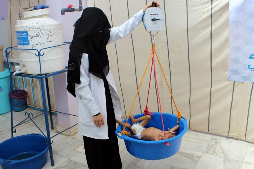 TOPSHOT - A Yemeni child suffering from severe malnutrition is weighed at a treatment centre in a hospital in Yemen's northwestern Hajjah province, on November 7, 2018. - Thirty-five Yemeni and international NGOs called on November 7 for an "immediate cessation of hostilities" in Yemen, where they warned 14 million people were now "on the brink of famine". (Photo by ESSA AHMED / AFP)ESSA AHMED/AFP/Getty Images ** OUTS - ELSENT, FPG, CM - OUTS * NM, PH, VA if sourced by CT, LA or MoD **