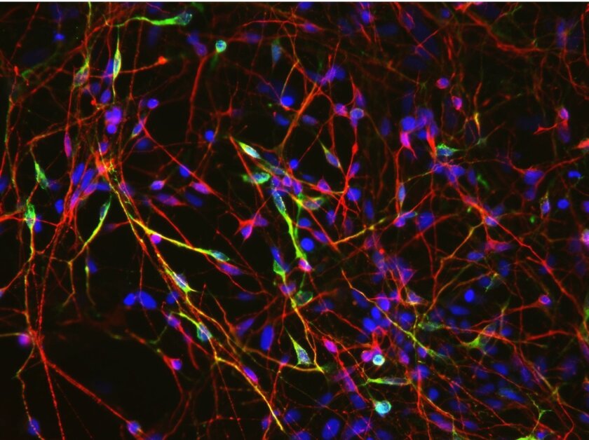 Dopaminergic neurons derived from induced pluripotent stem cells. These neurons are destroyed in Parkinson's disease.