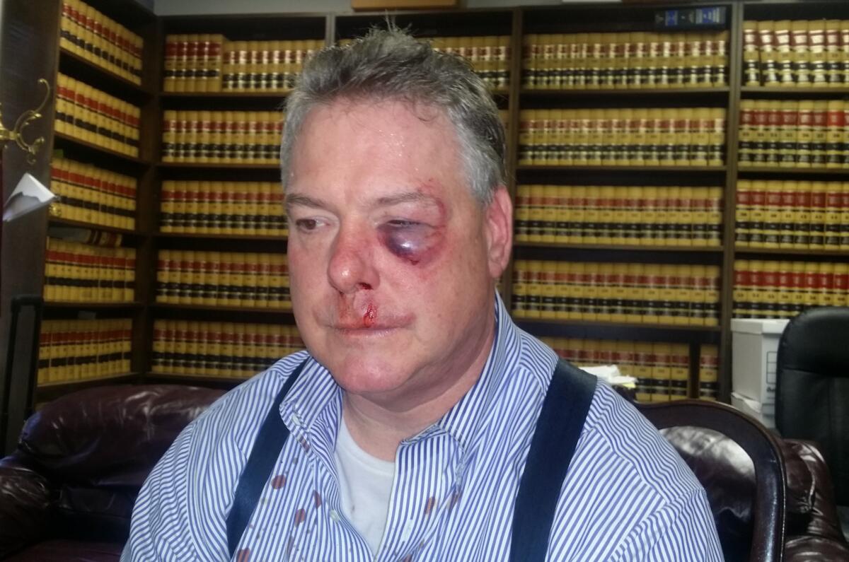 Defense attorney James Crawford after the courthouse brawl.
