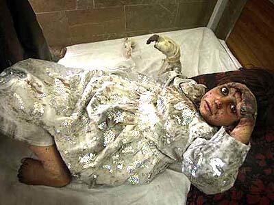 7-yr-old Fermina Bibi lies burned and broken, still in the "special dress" she wore to her sister's house in Urozgan, Afghanistan, when a bomb dropped by U.S. war planes exploded.