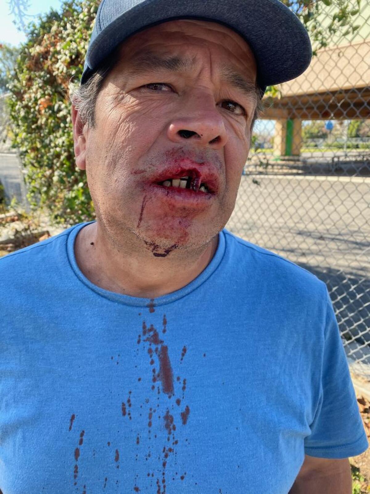 El costarricense Minor Bravo fue atacado por un hombre asiático en el vecindario Mid-City,