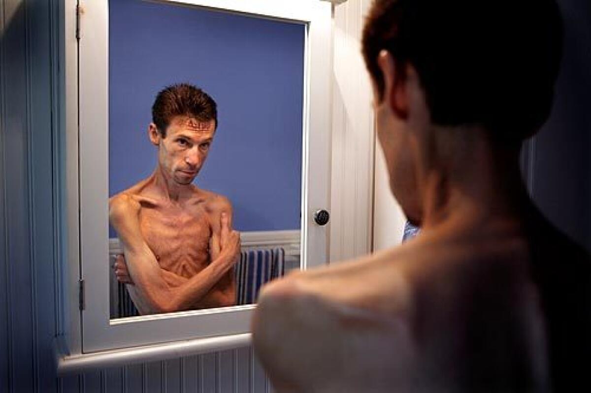 Bryan Bixler feels he can't escape the truth in the mirror. At 39 years old, 5 foot 9 and 82 pounds, he is growing weaker by the day. > > > Audio slideshow
