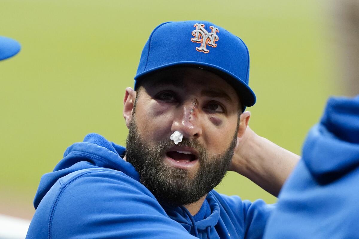 New York Mets' Kevin Pillar talks to teammates in the dugout before the team's baseball game against the Atlanta Braves on Tuesday, May 18, 2021, in Atlanta. Pillar was hit on the face with a Jacob Webb fastball the night before. (AP Photo/John Bazemore)