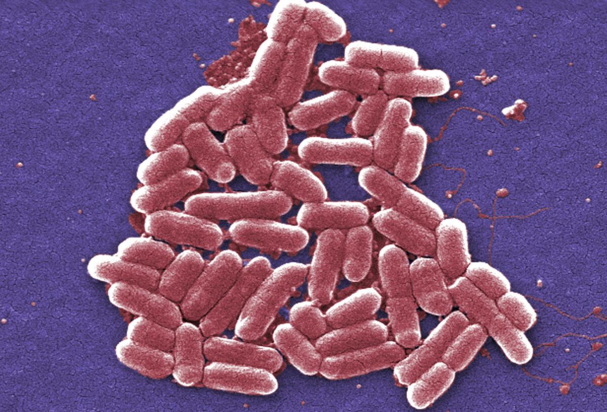 Un número creciente de bacterias de E. coli, mostradas en la imagen, son resistentes a la colistina, un antibiótico empleado como último recurso (Janice Carr / Associated Press).