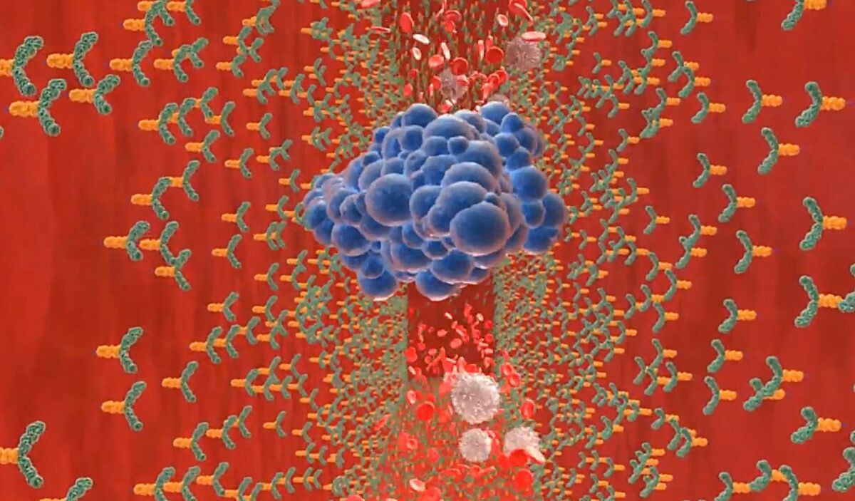 A cluster of cancer stem cells, blue, is caught by antibodies in this animation of how the diagnostic chip would work. — Jeff Allen