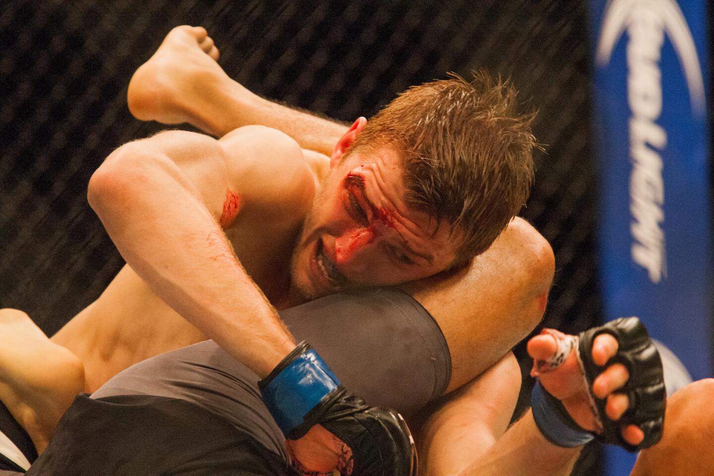 Daniel Hooker bleeds from his eye during the first round of his bout against Yair Rodriguez at UFC 192. Rodriguez won by unanimous decision.