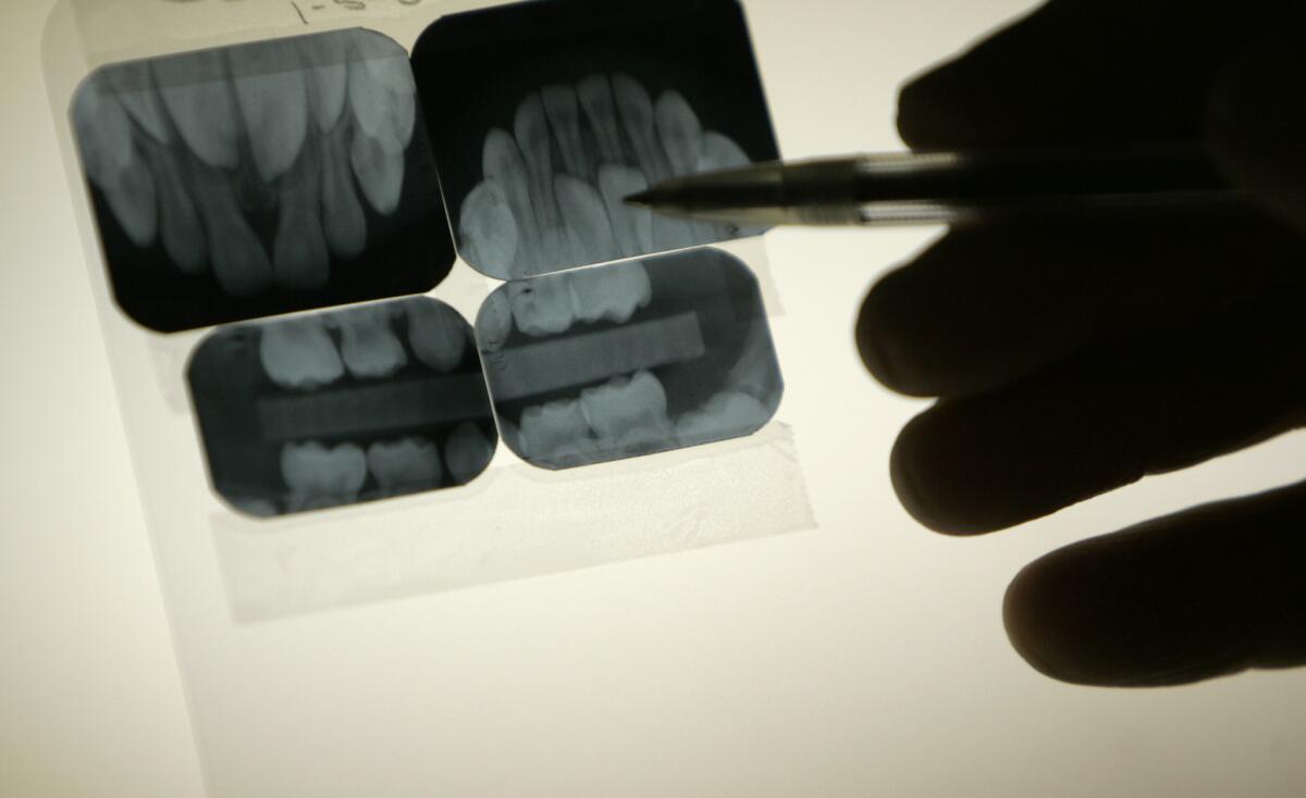 A dentist examines a set of newly taken X-rays.