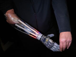 Dale DiMassi, creative marketing manager at Psyonic, demos a prosthetic hand at Humanoids Summit.