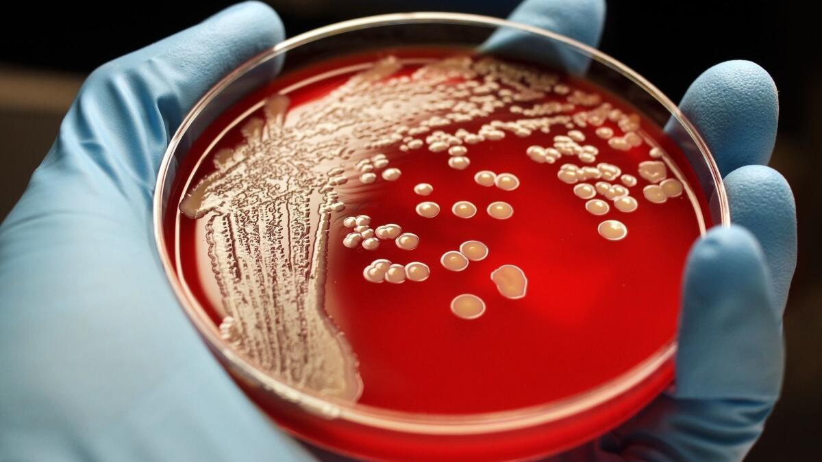 A laboratory worker holds MRSA colonies on a blood agar plate in a 2011 file photo. Los Angeles Police Department officers may have been exposed to the bacteria, officials said Tuesday.