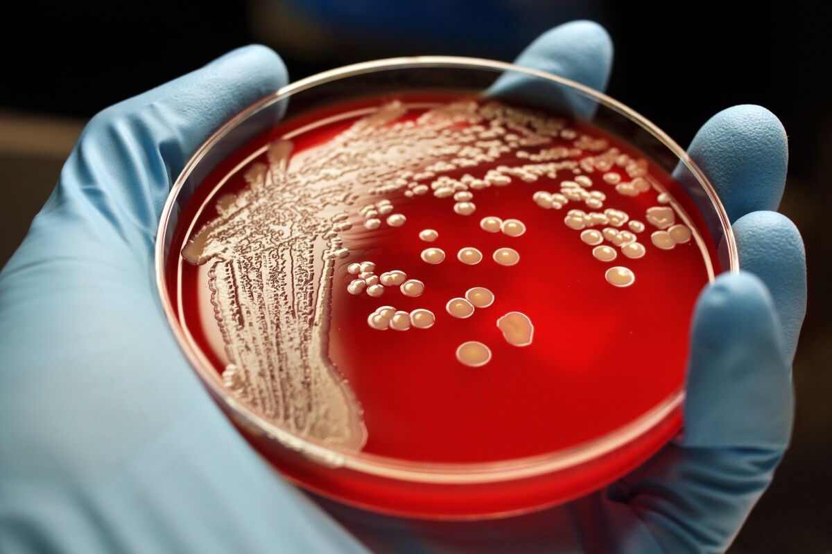 Colonies of Methicillin-resistant Staphylococcus aureus on a blood agar plate.