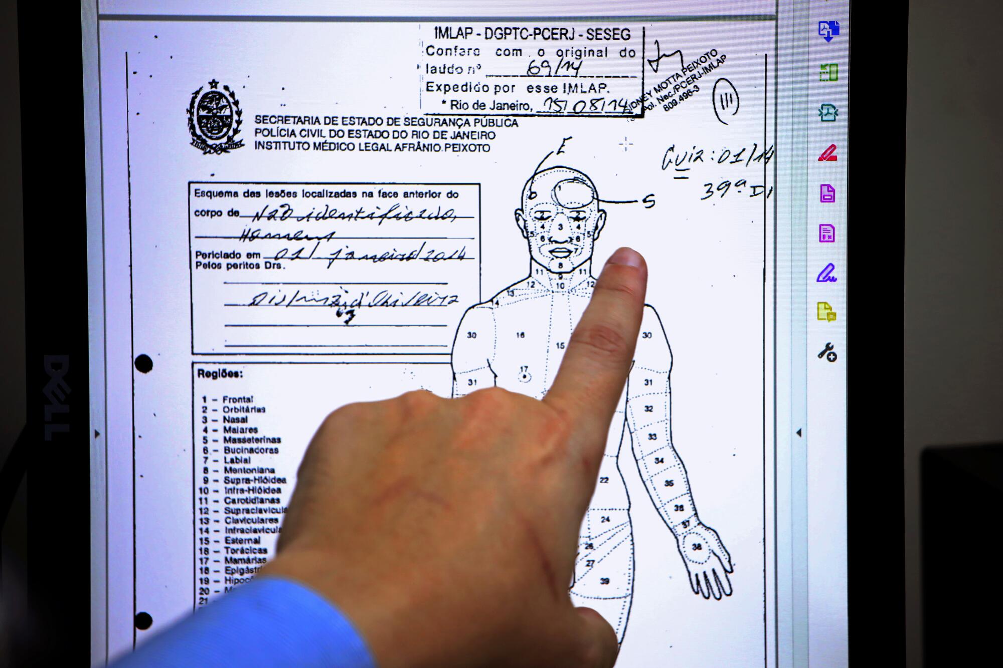 A finger points at an autopsy report.