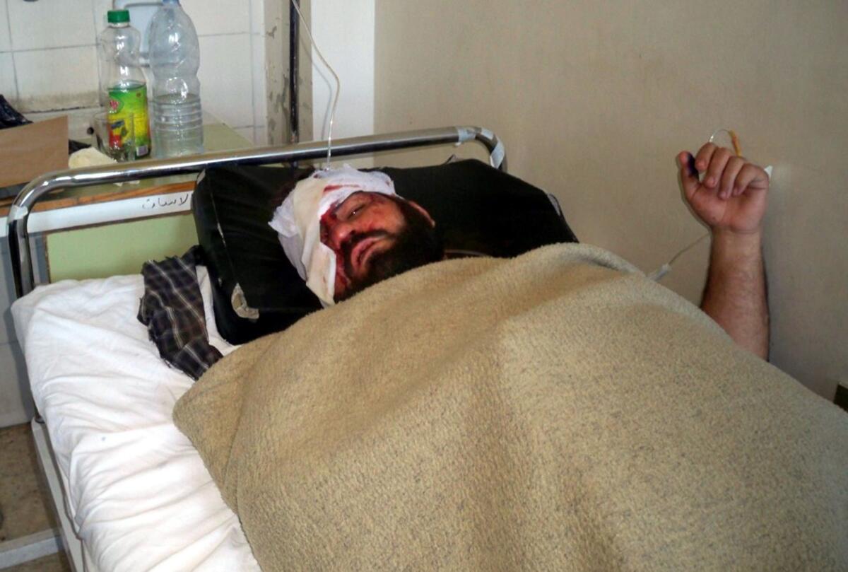 A photo released by the official Syrian Arab News Agency shows an injured man in a hospital bed in Hama after a car bomb attack.